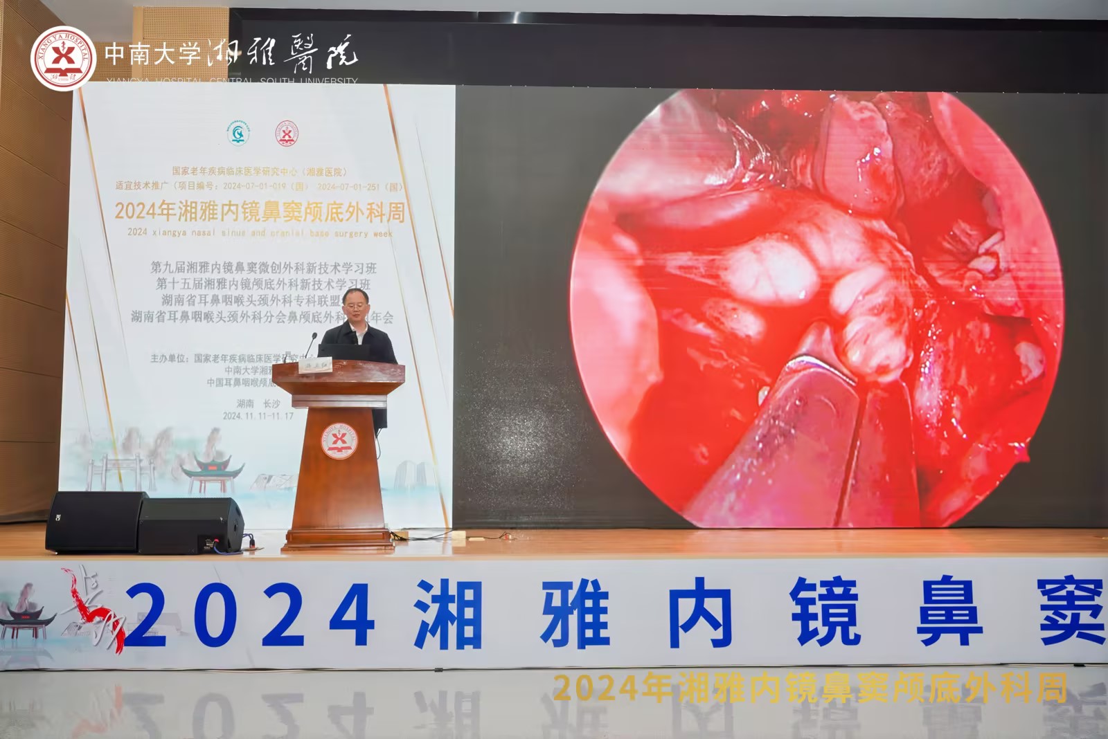夹式双级、钨针术中应用亮相2024湘雅内镜鼻窦颅底外科周